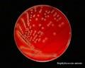 staphylococcus aureus